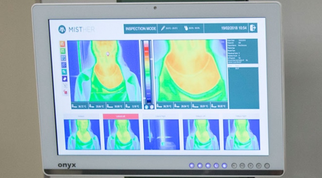 Kanserde ‘kızılötesi’ ile radyasyonsuz teşhis dönemi